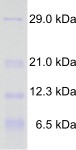 Product Image Proteintestmischung 5 für SDS PAGE_