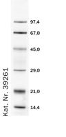Fluoreszenzmarkierter-Standard-s_1.jpg
