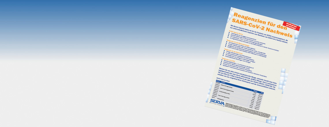SLIDER_JD_SARS_DE_V1.jpg